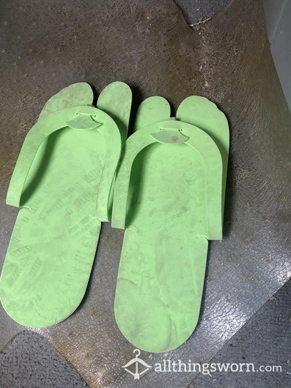 Dirty Pedicure Slippers Left In Car For Weeks