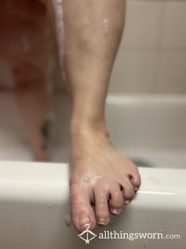 Foot Peel With Video And Pics