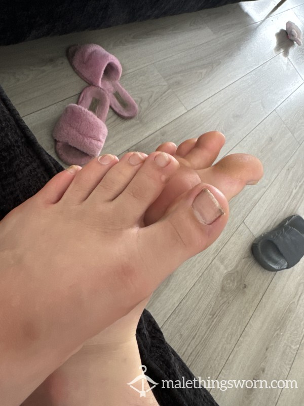 Toe Nails & Toe Fluff
